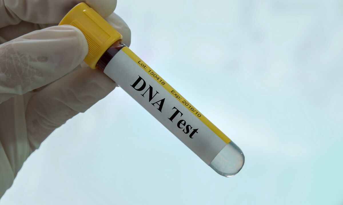 DNA test prøve